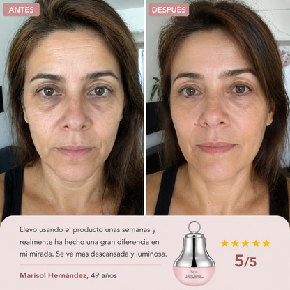 CREMA DE LUZ ROJA PARA EL CONTORNO DE OJOS - YCZ